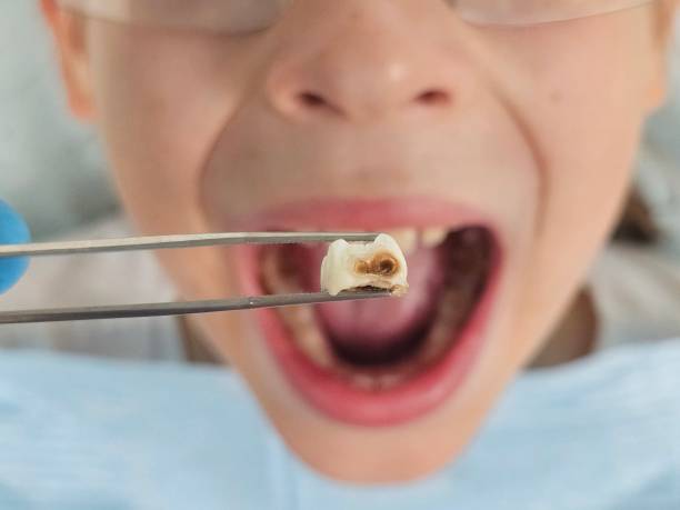 Best Emergency Pediatric Dentist  in Rainbow, CA